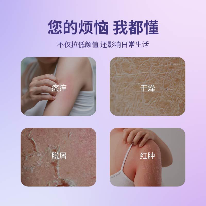 Yaguo Ning skin care liquid dressing skin itching spray desquamation drying manufacturer wholesale drop shipping support customization